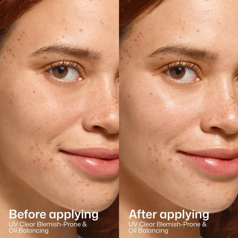 UV Clear Blemish-Prone & Oil Balancing SPF 50
