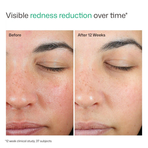 UV Skin Recovery Broad Spectrum SPF 50 Face Sunscreen