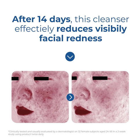 Skin Recovery Amino Acid Foaming Cleanser