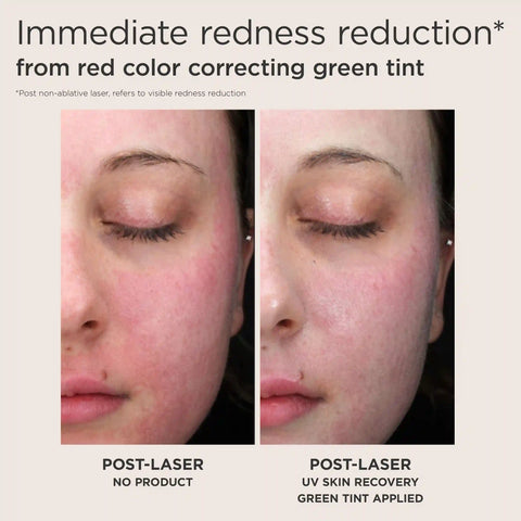 Post-Procedure Skincare Kit